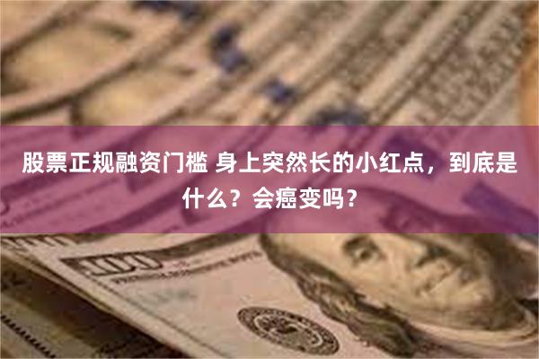 股票正规融资门槛 身上突然长的小红点，到底是什么？会癌变吗？